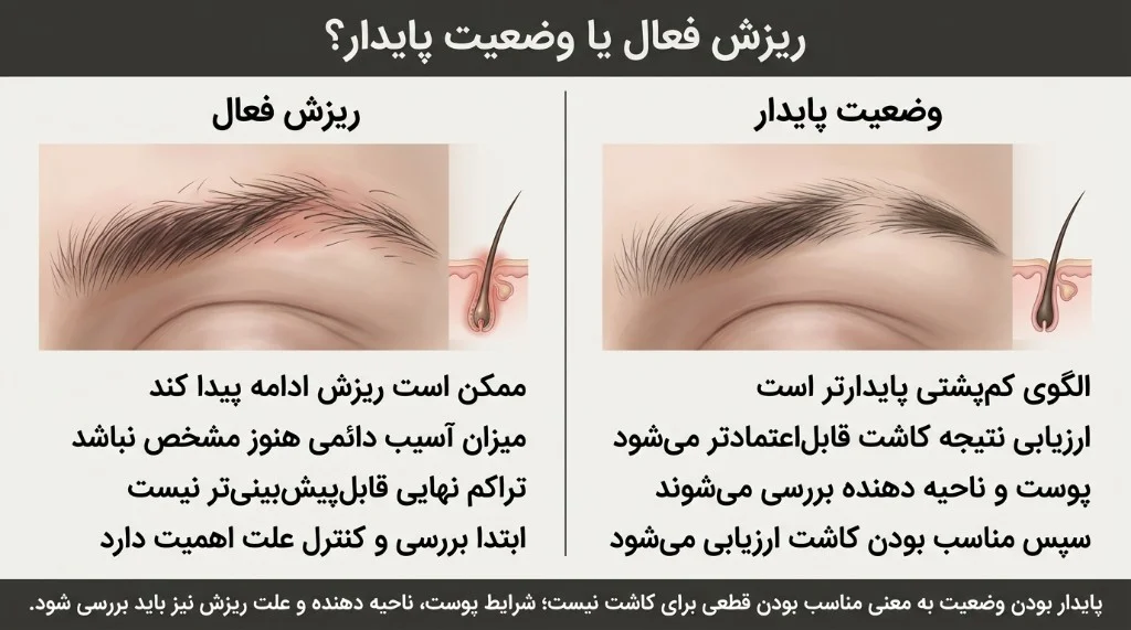 ریزش فعال ابرو در برابر الگوی پایدارتر