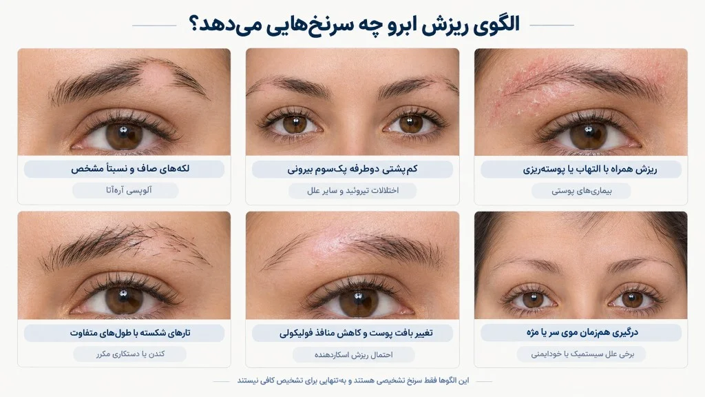 الگوی ریزش ابرو چه سرنخ‌هایی می‌دهد؟ — اینفوگرافیک آموزشی