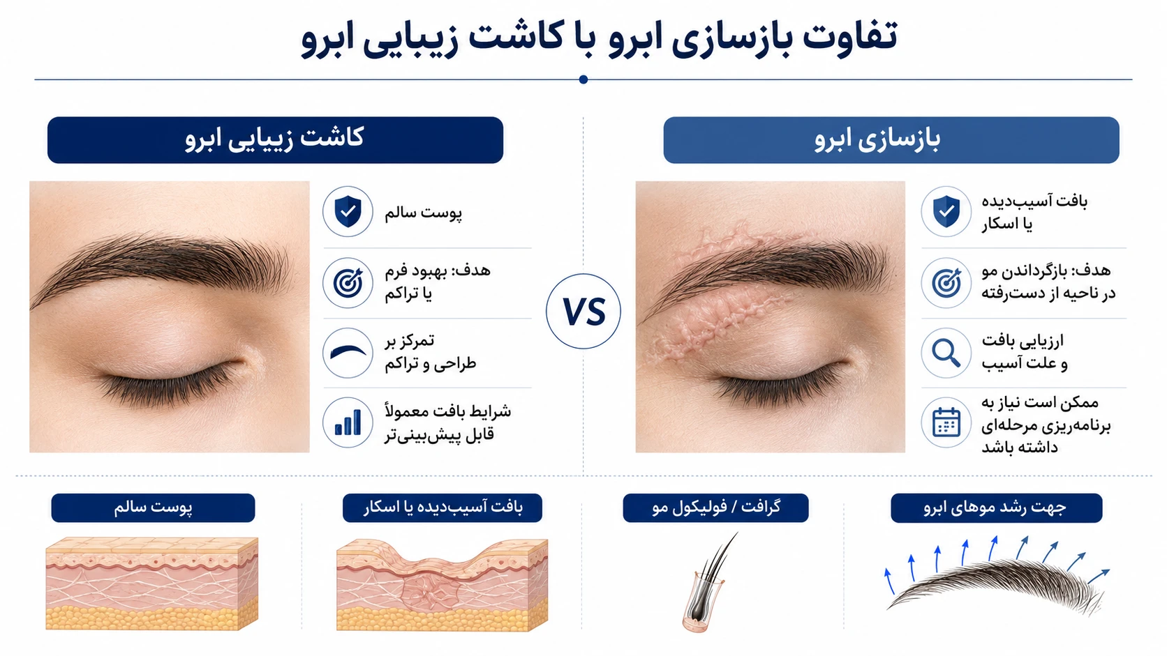 مفهوم بازسازی ابرو