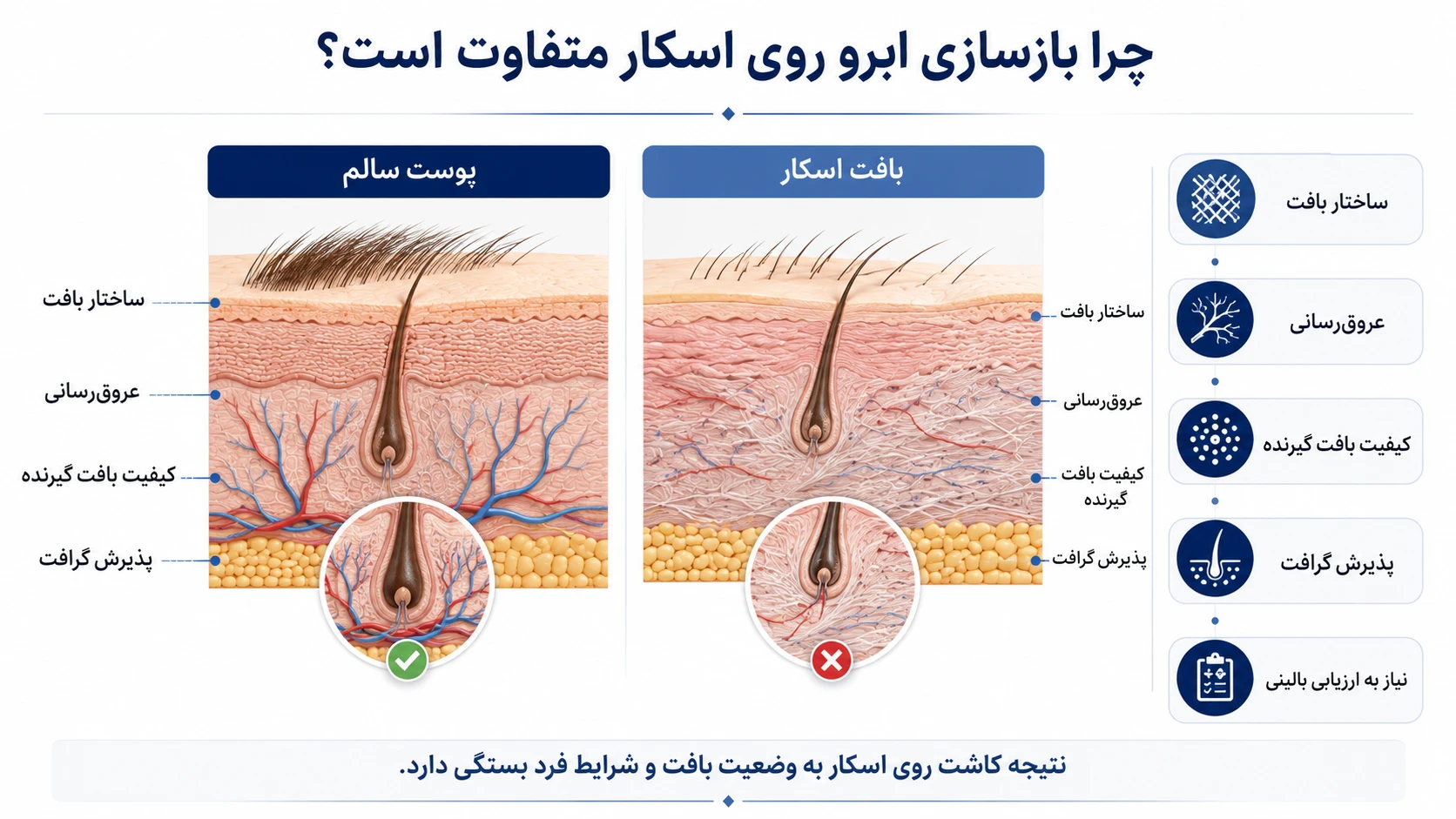 شرایط مطرح‌شدن بازسازی ابرو