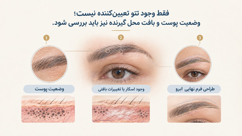 وجود تتو به‌تنهایی تعیین‌کننده نیست؛ وضعیت پوست، اسکار و طراحی نهایی بررسی می‌شود