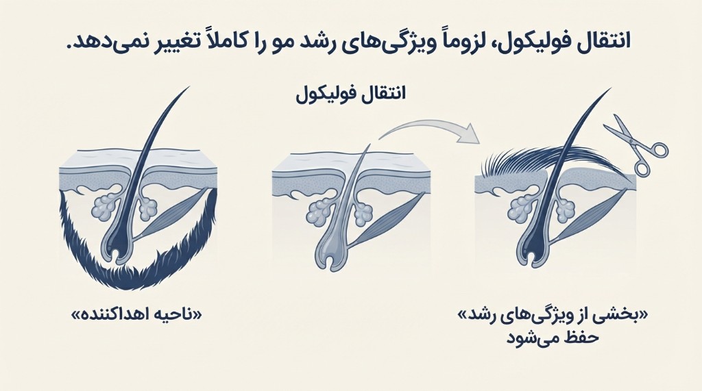 غلبه ناحیه اهداکننده — فولیکول منتقل‌شده بخشی از ویژگی‌های رشدی ناحیه اصلی را حفظ می‌کند