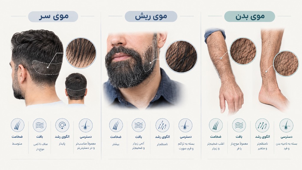 مقایسه منابع موی سر، ریش و بدن برای کاشت ابرو