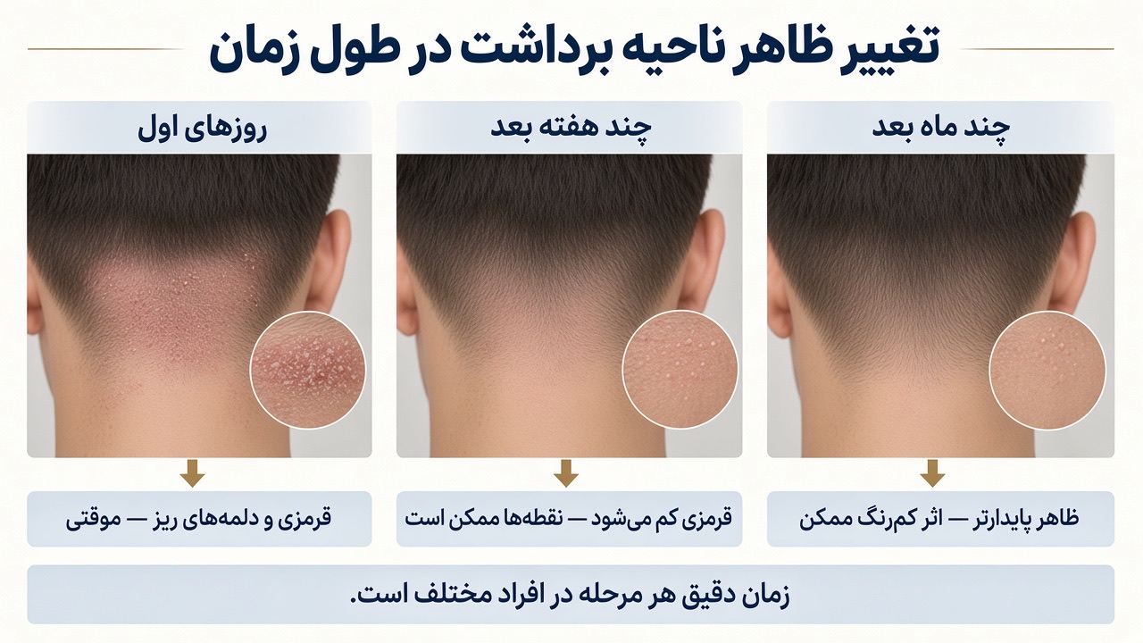تغییر ظاهر ناحیهٔ برداشت از روزهای اول تا ماه‌های بعد