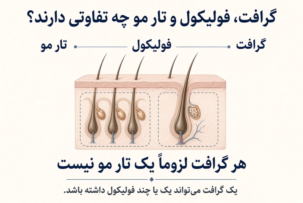 گرافت، فولیکول و تار مو چه تفاوتی دارند؟