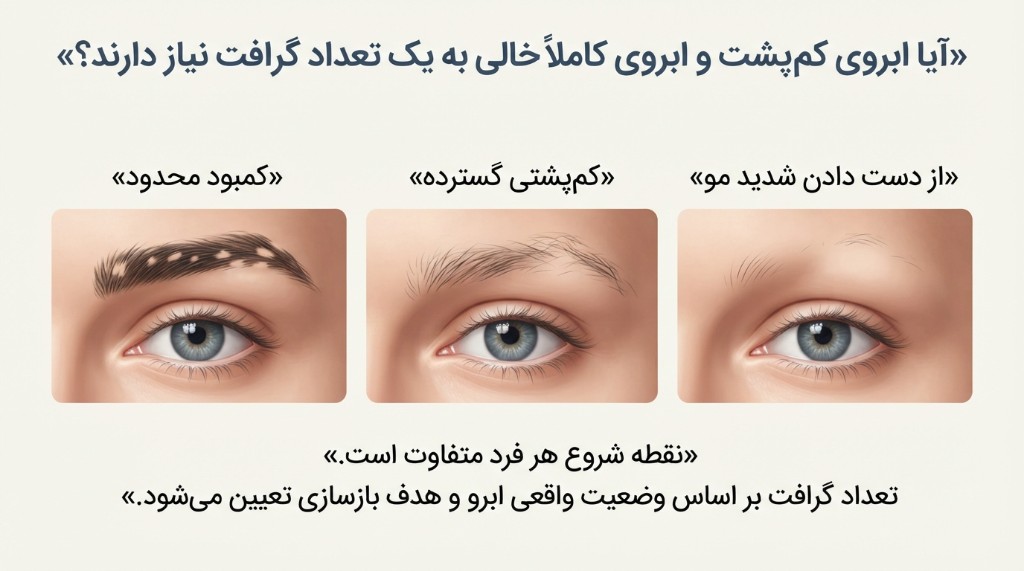 آیا ابروی کم‌پشت و ابروی کاملاً خالی به یک تعداد گرافت نیاز دارند؟