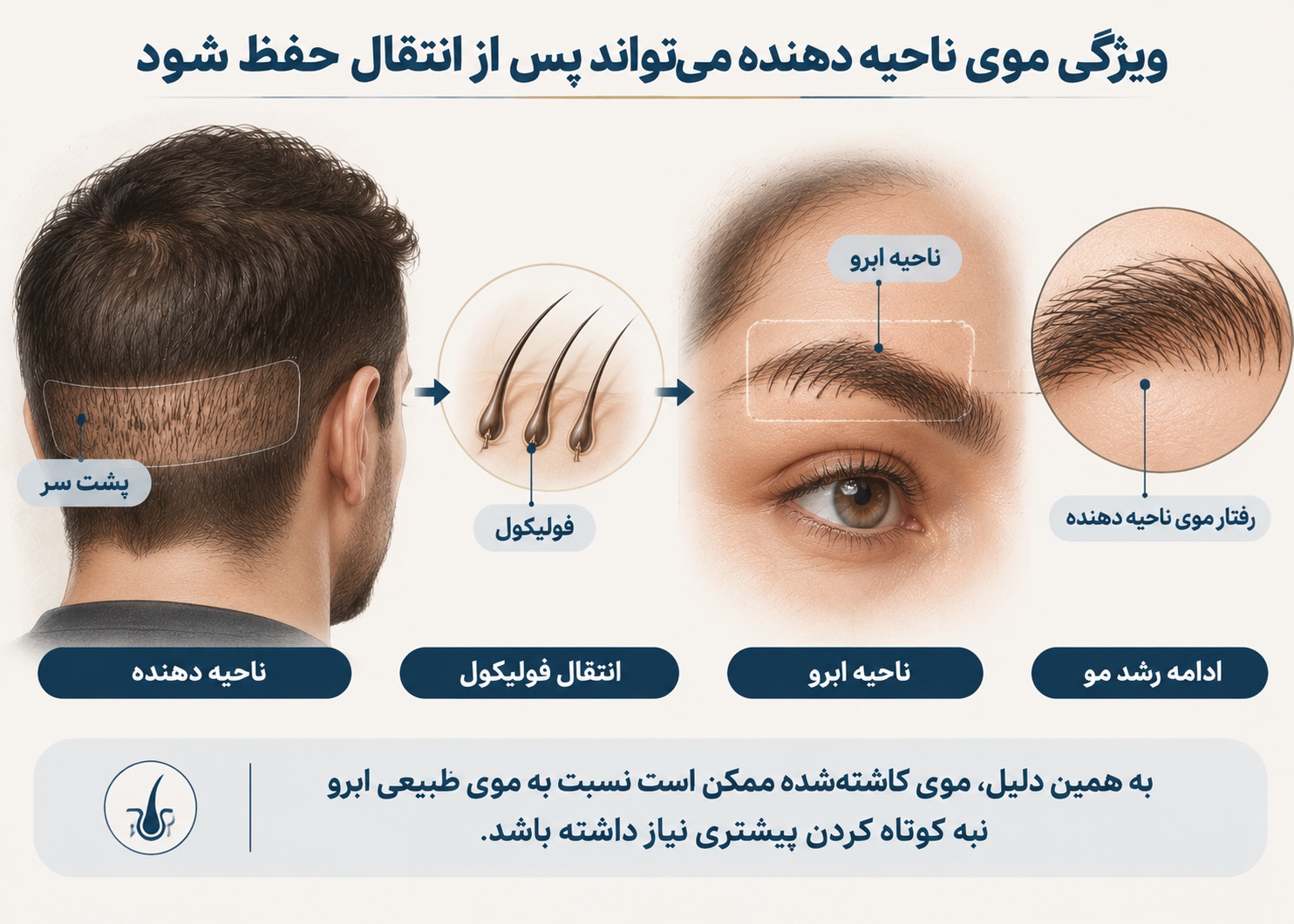 ویژگی موی ناحیه دهنده می‌تواند پس از انتقال حفظ شود