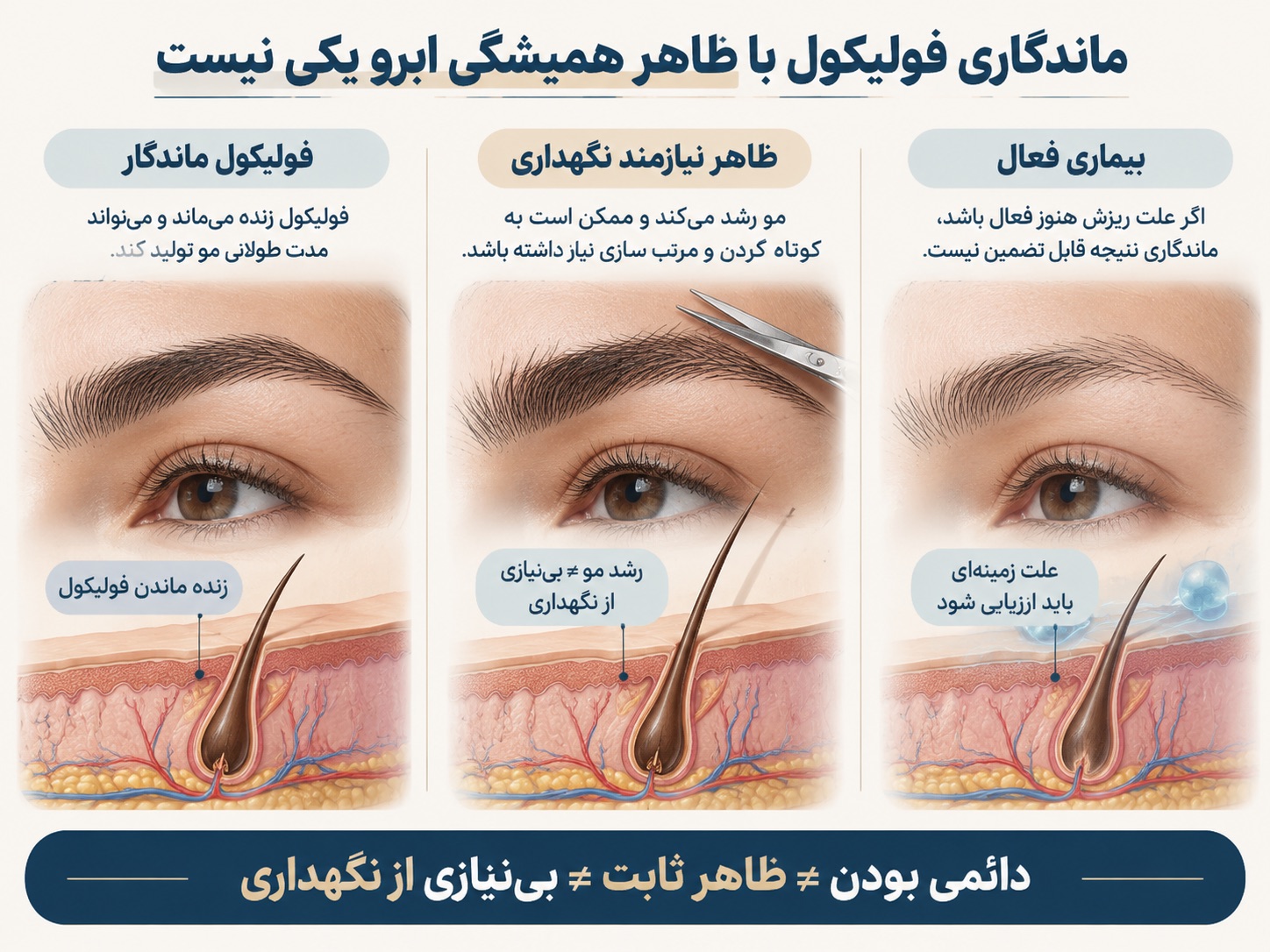 ماندگاری فولیکول با ظاهر همیشگی ابرو یکی نیست