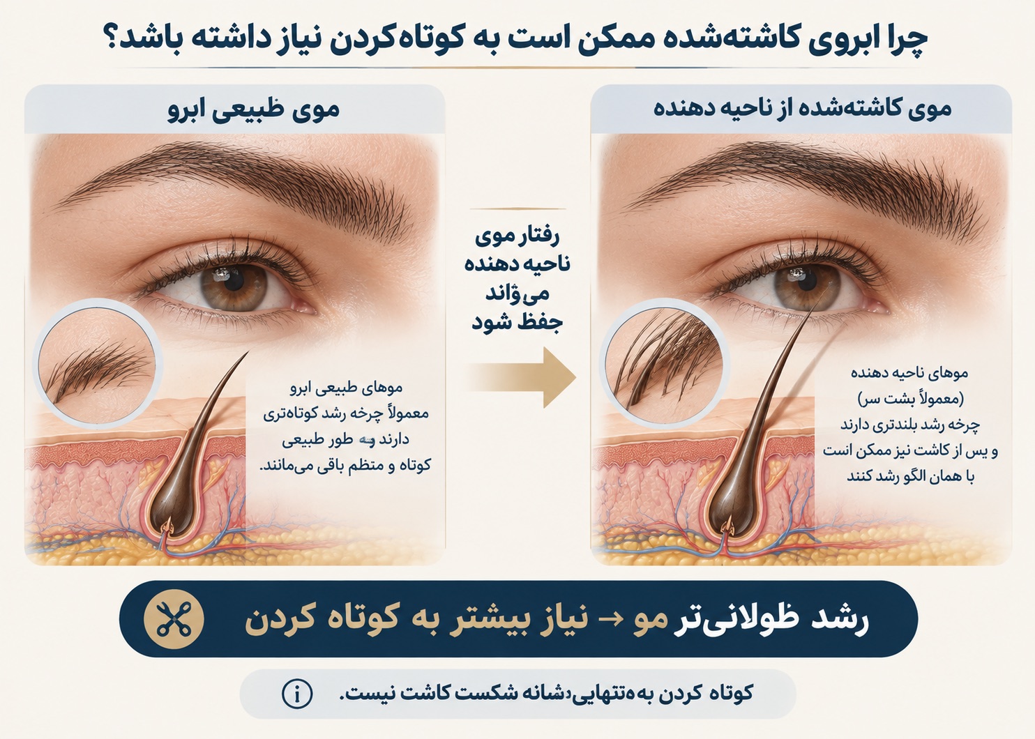 چرا ابروی کاشته‌شده ممکن است به کوتاه‌کردن نیاز داشته باشد