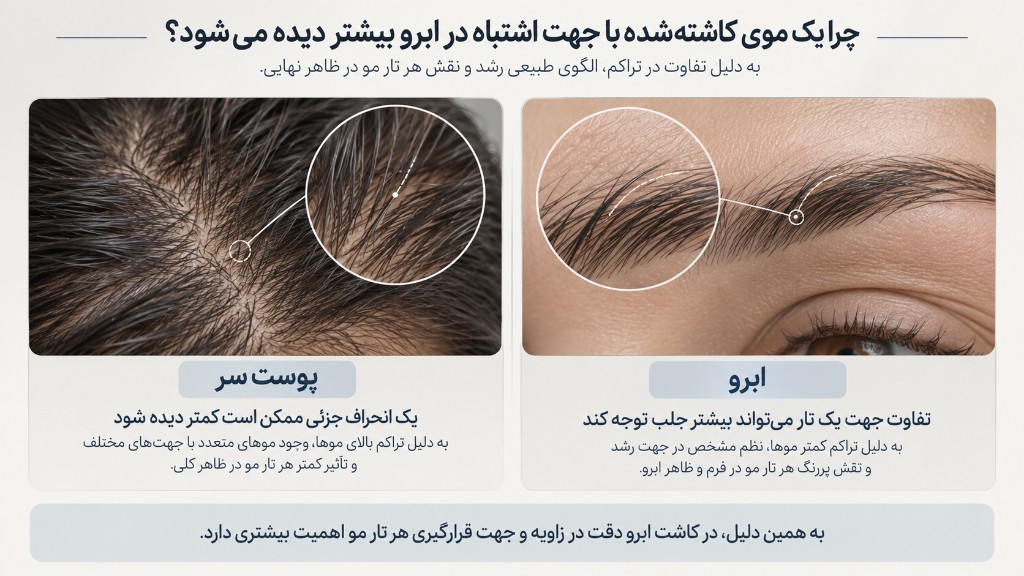 چرا موی کاشته‌شده با جهت اشتباه در ابرو بیشتر دیده می‌شود؟