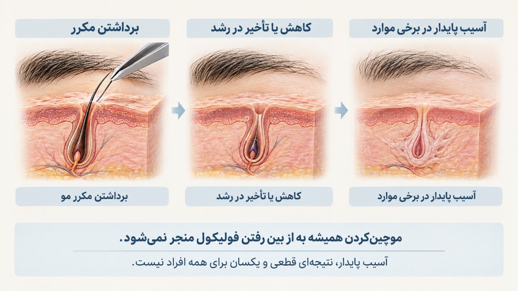 مراحل احتمالی آسیب فولیکول در برداشتن مکرر ابرو