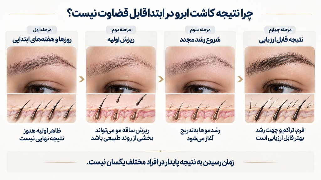 چرا نتیجه کاشت ابرو در ابتدا قابل قضاوت نیست: هفته‌های اول، ریزش اولیه، شروع رشد مجدد، سپس ظاهر پایدارتر