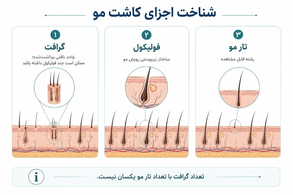 تفاوت گرافت، فولیکول و تار مو: چرا تعداد گرافت با تعداد تار مو یکی نیست