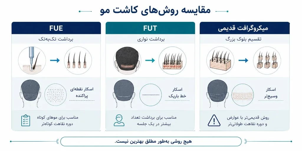 مقایسه FUE، FUT و میکروگرافت یا مینی‌گرافت قدیمی از نظر برداشت و الگوی اسکار