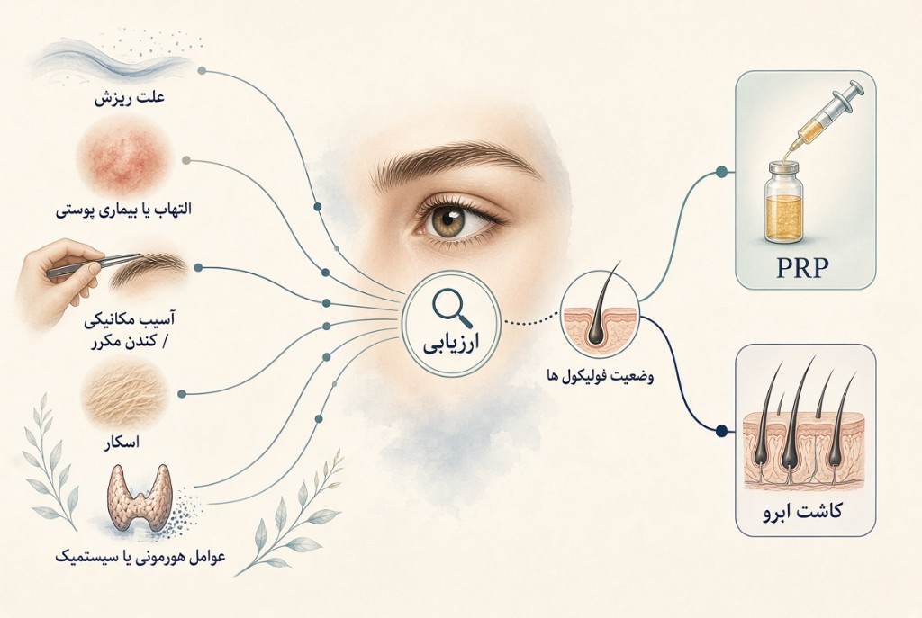 مسیر ارزیابی علت ریزش ابرو تا انتخاب PRP یا کاشت