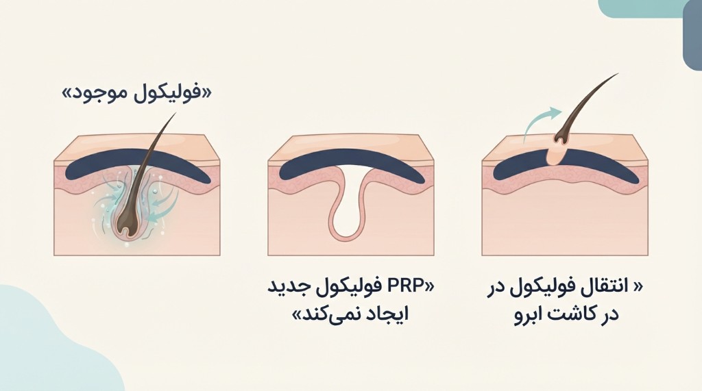 PRP فولیکول جدید ایجاد نمی‌کند — حمایت از فولیکول موجود در برابر انتقال فولیکول در کاشت