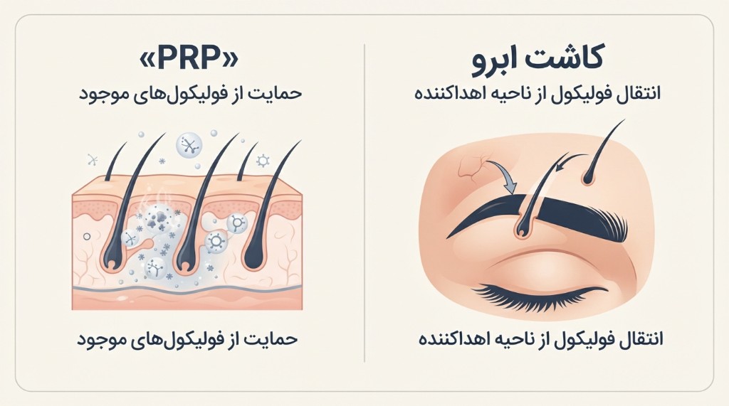 مقایسه PRP و کاشت ابرو — حمایت از فولیکول موجود در برابر انتقال فولیکول