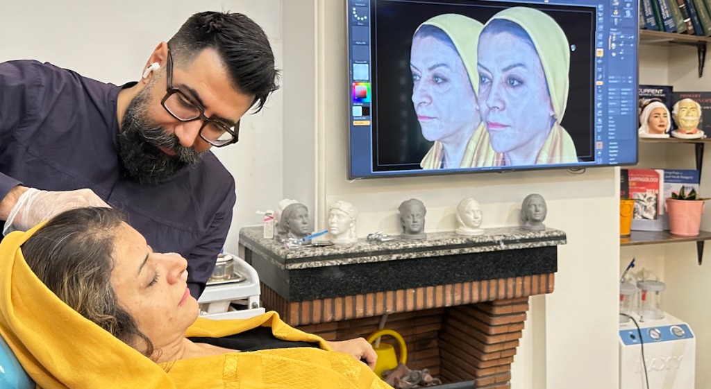 کاشت ابرو برای بانوان